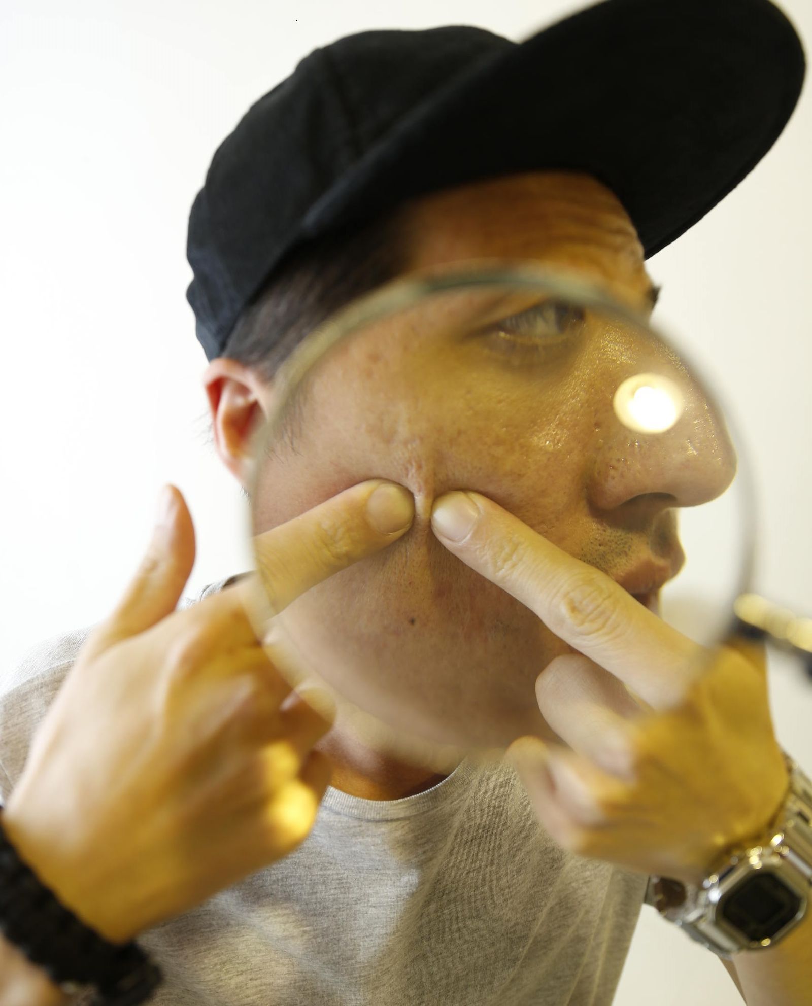 別再擠了 用對方法就能在粉刺痘痘冒出頭前先絕後患型男保養GQ瀟灑男人網